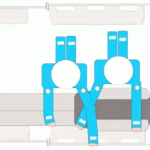 Positioning stretcher spoon Posizionamento barella a cucchiaio
