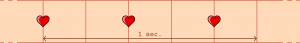 ecg_filippo-150